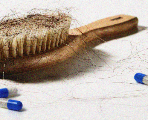 -برای-جلوگیری-از-ریزش-مو-495x400 ویتامین‌هایی برای جلوگیری از ریزش مو