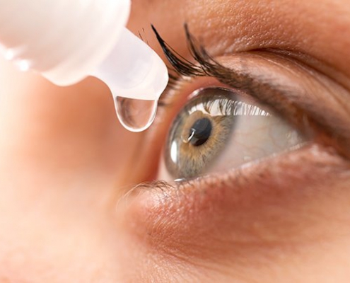 -چشم،-علت-و-علائم-آن-495x400 Dry eye, cause and symptoms